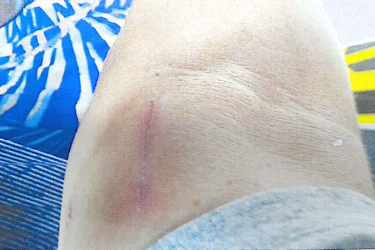 foto Not&iacute;cia Guarujá